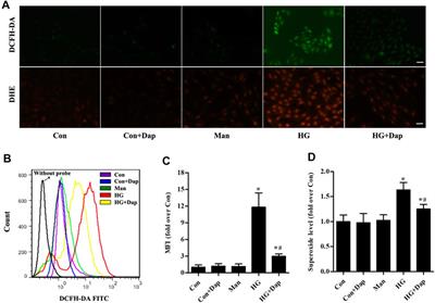 A SGLT2 Inhibitor Dapagliflozin Alleviates Diabetic Cardiomyopathy by Suppressing High Glucose-Induced Oxidative Stress in vivo and in vitro